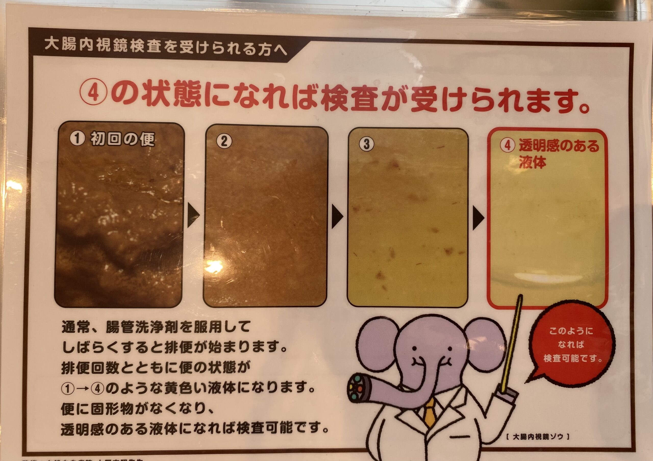 大腸内視鏡検査は個室トイレ付が◎当院で大腸カメラを快適に受けられる理由