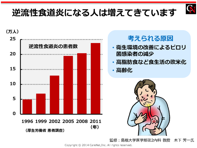 胸やけは胃カメラで原因が判明する?すぐに受診するべき胸やけの症状と治療方法